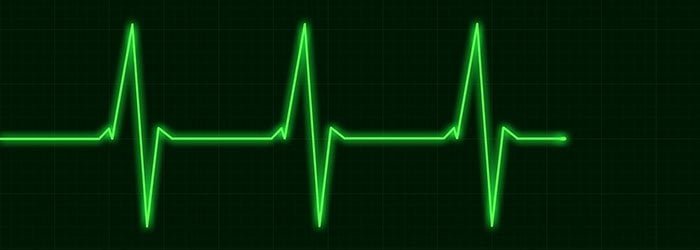 How support and resistance zones work in forex trading